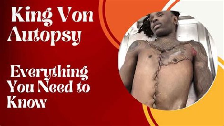 Exploring The Aftermath: The Autopsy Report Of King Von