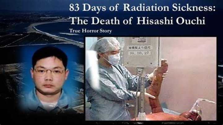Hisashi Ouchi: A Tragic Tale Of Radiation Exposure