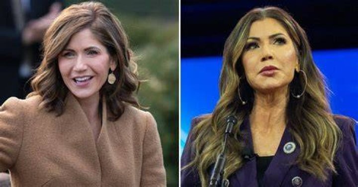 Kimberly Guilfoyle Enhances Her Beauty: A Plastic Surgery Journey