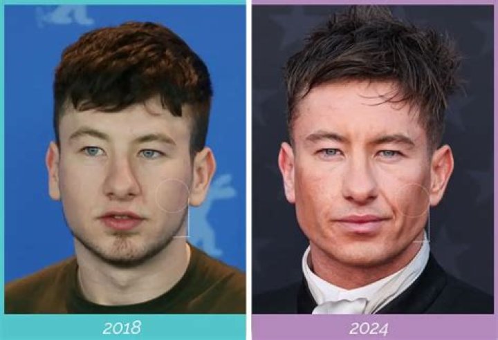 Understanding Barry Keoghan's Unique Appearance: Why Does Barry Keoghan Look Asian?