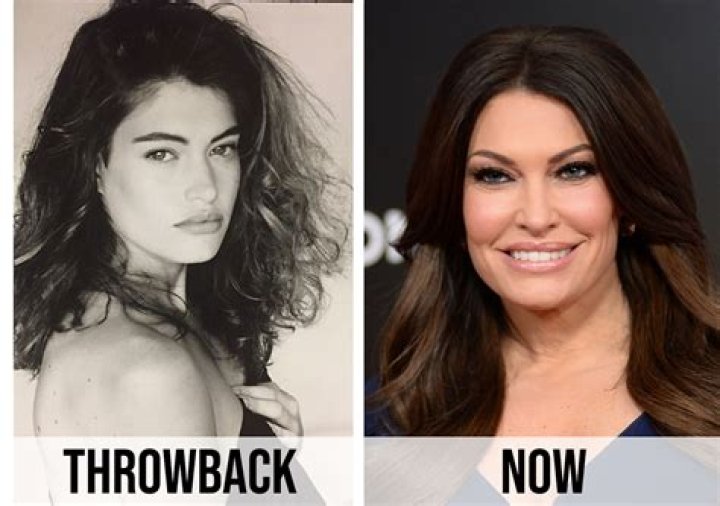 Unveiling The Allure Of Kim Guilfoyle's Lips